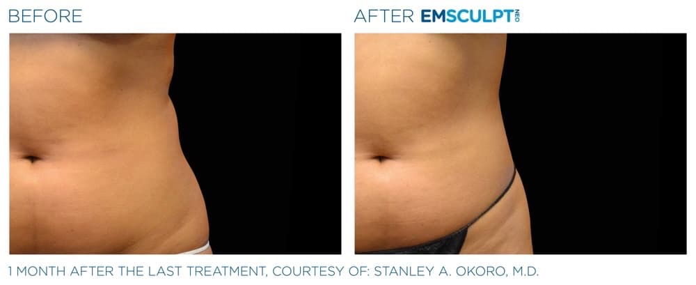 Treatment result 1