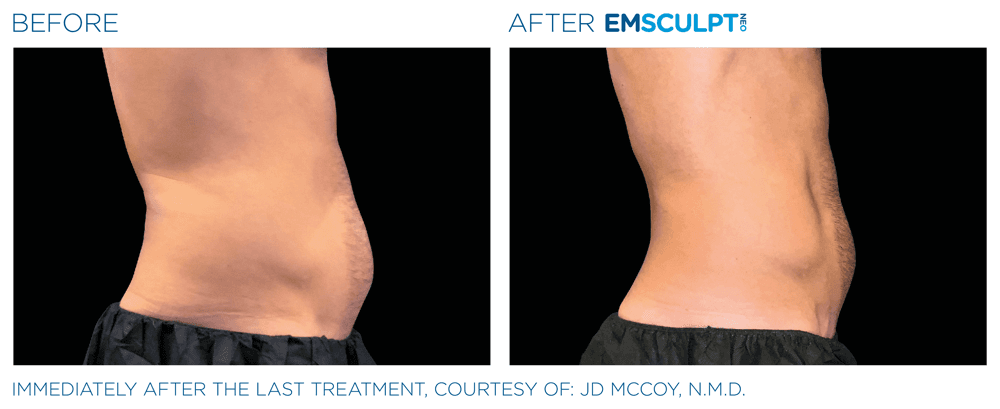 Treatment result 10
