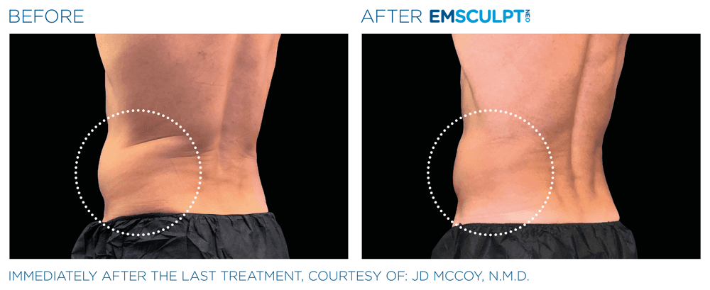 Treatment result 11