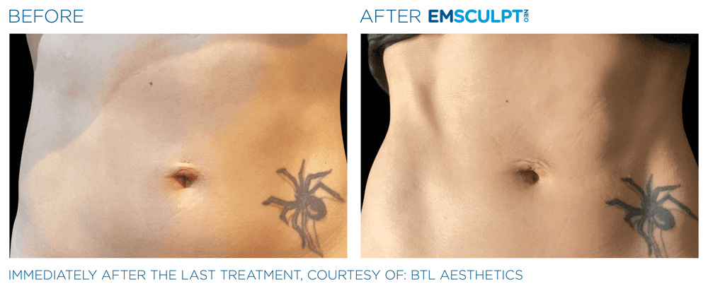 Treatment result 12