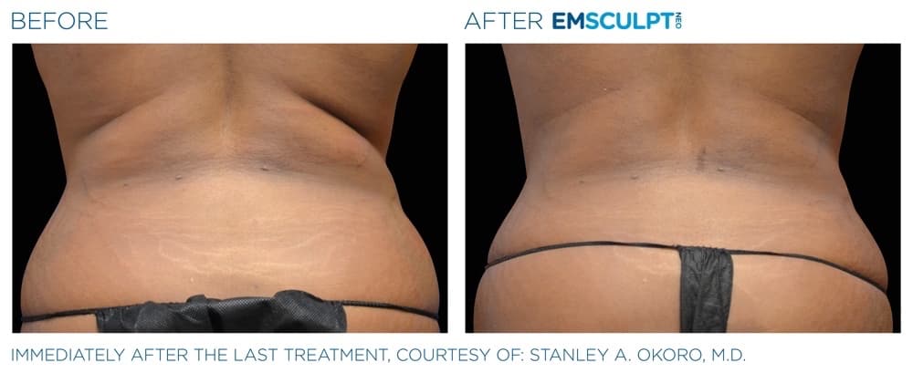 Treatment result 2