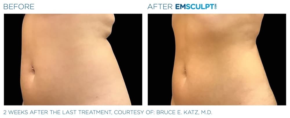 Treatment result 3