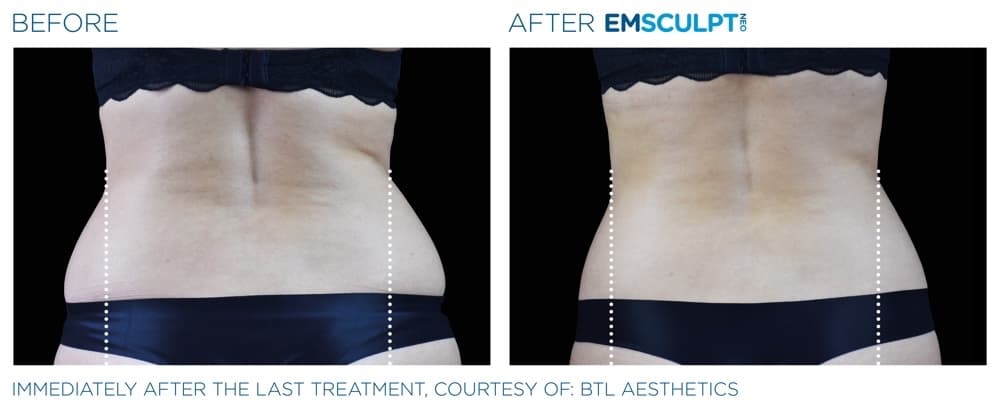 Treatment result 4