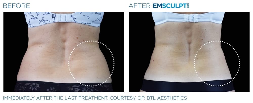 Treatment result 5
