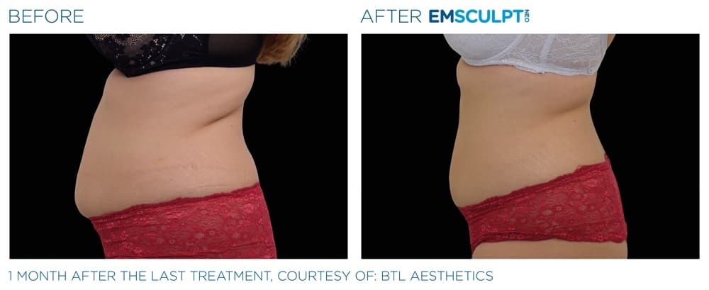 Treatment result 6