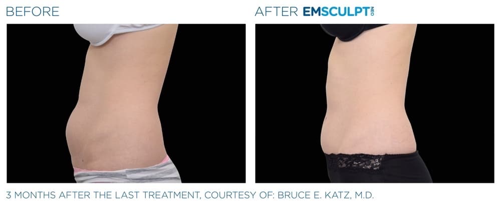 Treatment result 7