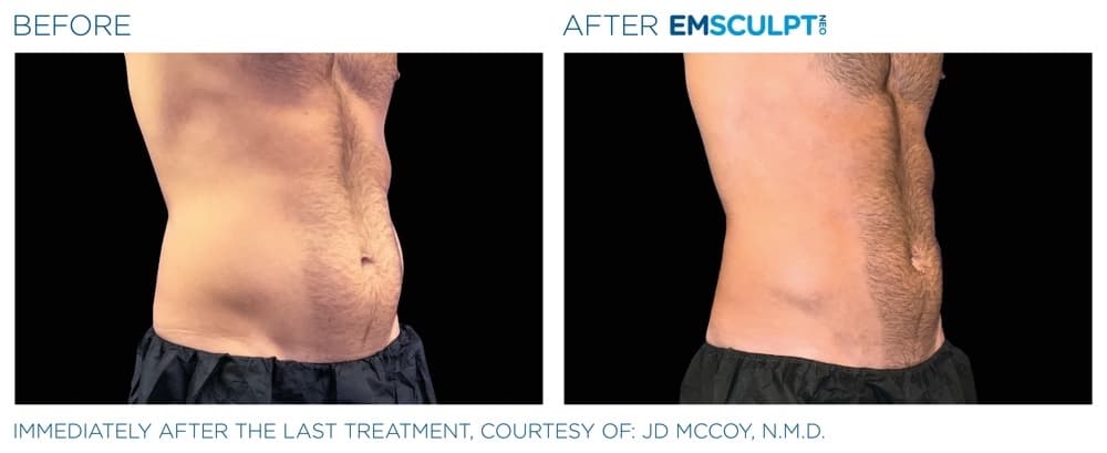 Treatment result 8