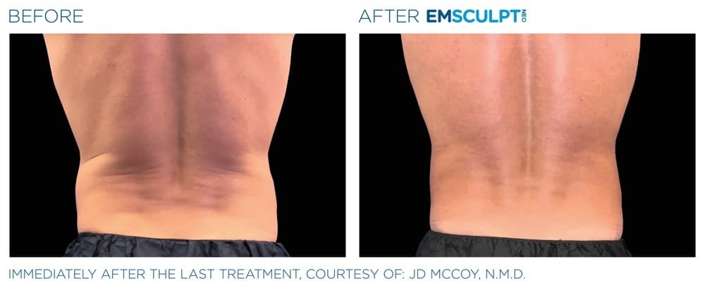 Treatment result 9