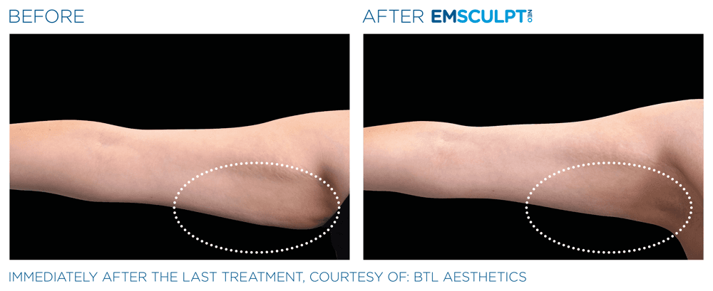 Treatment result 13