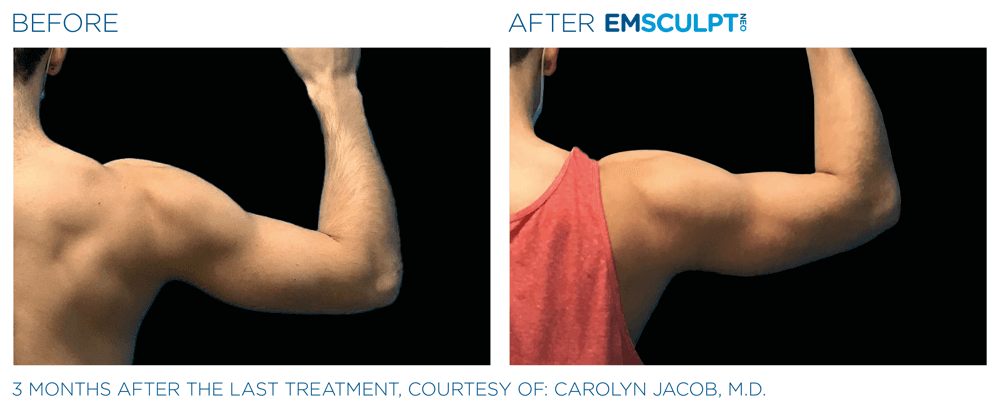 Treatment result 15