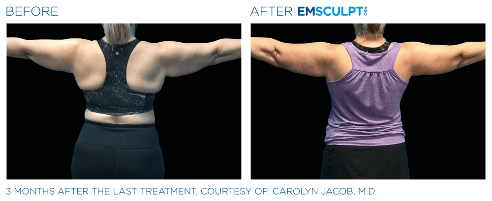 Treatment result 16