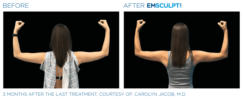 Treatment result 17
