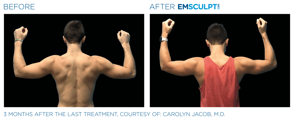 Treatment result 18