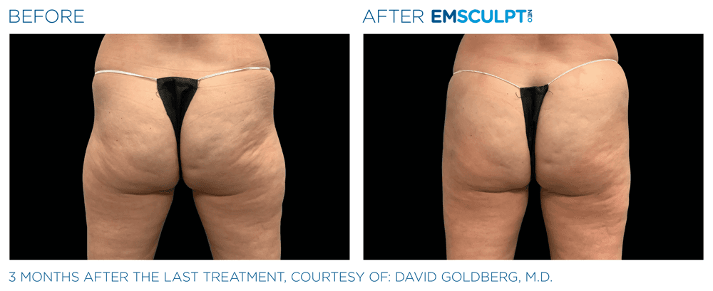 Treatment result 19