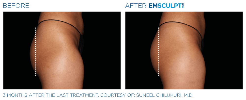 Treatment result 20