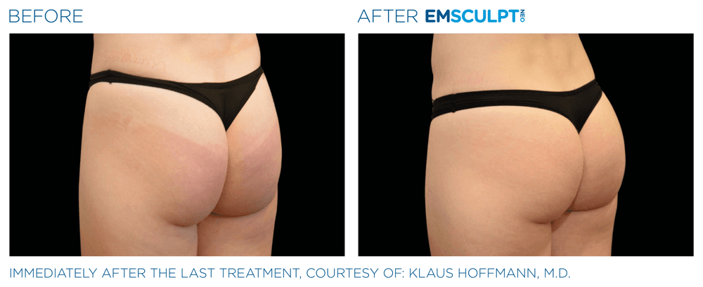 Treatment result 21