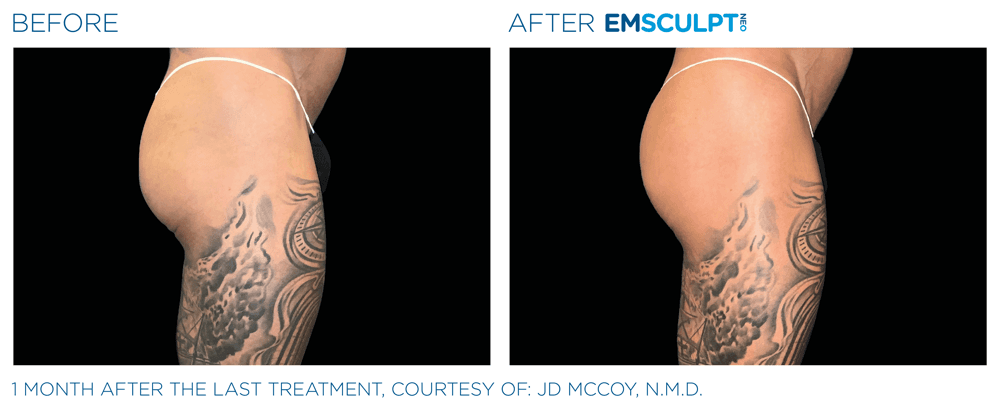 Treatment result 22