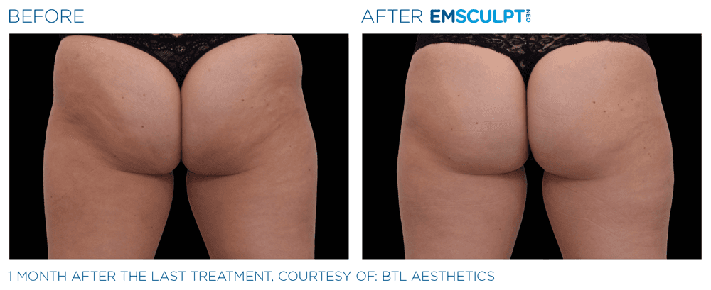 Treatment result 23