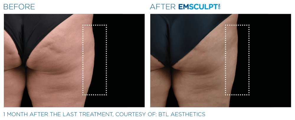 Treatment result 24