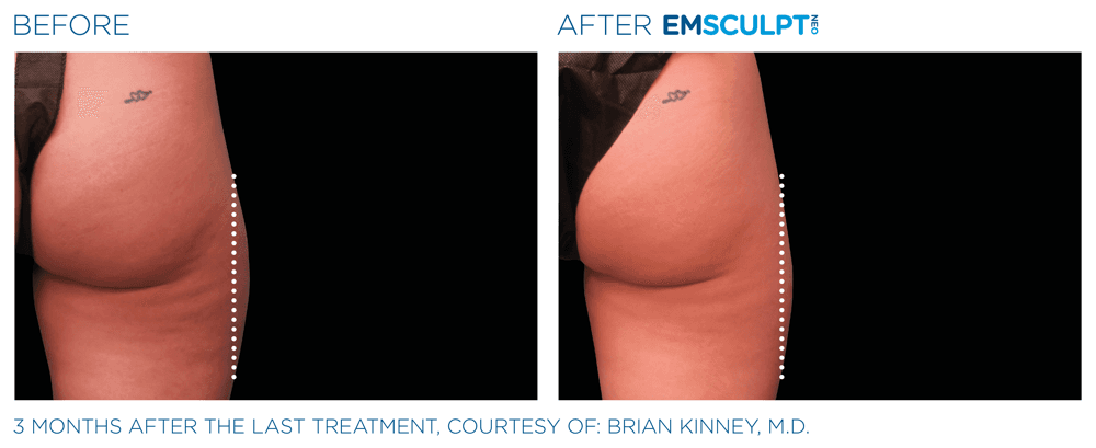 Treatment result 25
