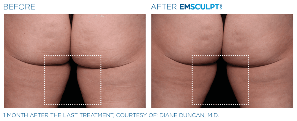 Treatment result 26