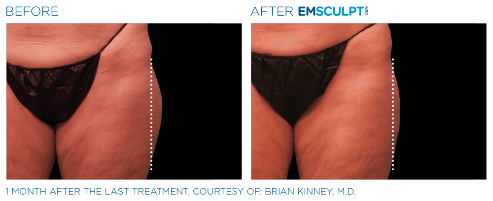Treatment result 29