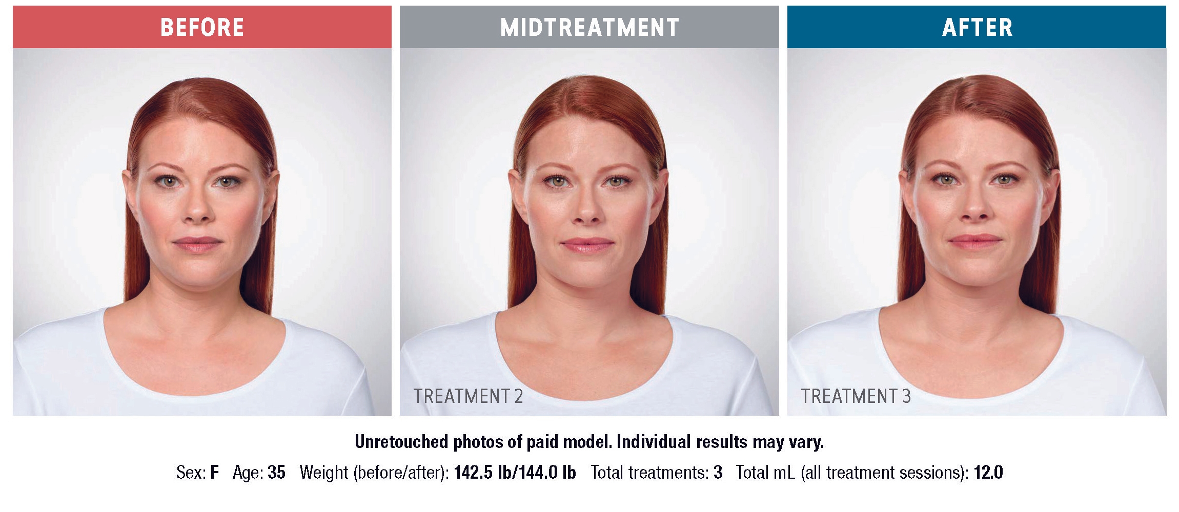Treatment result 1