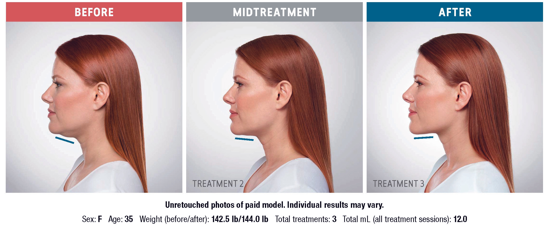 Treatment result 2