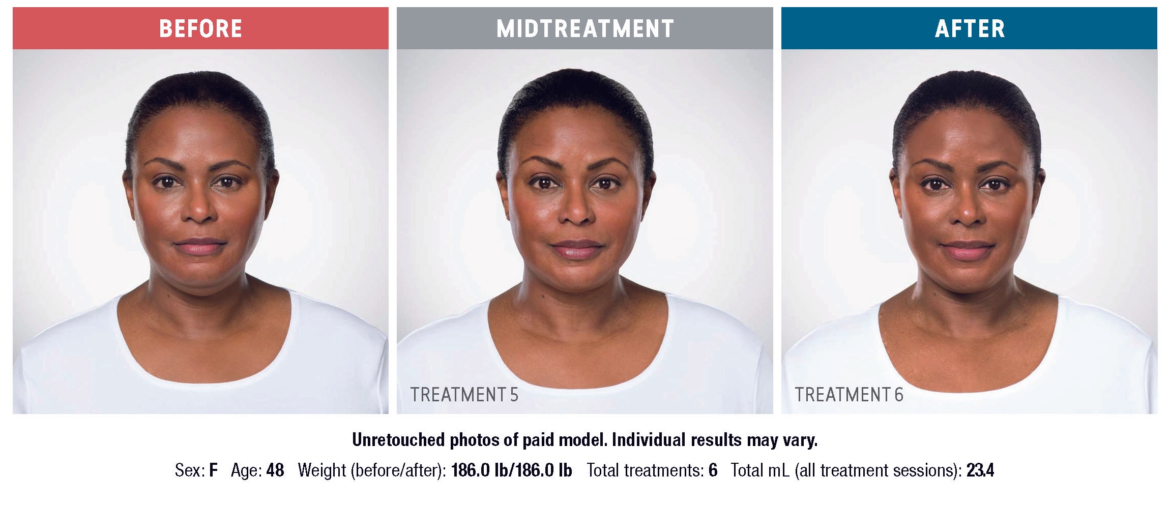Treatment result 3