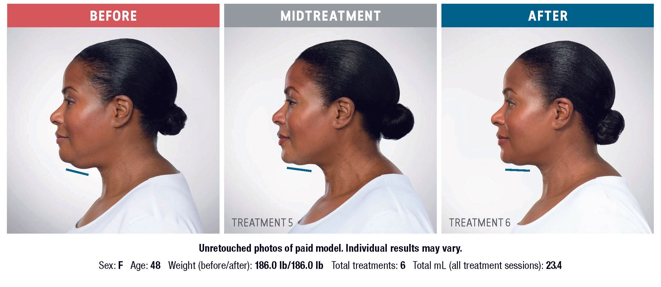 Treatment result 4