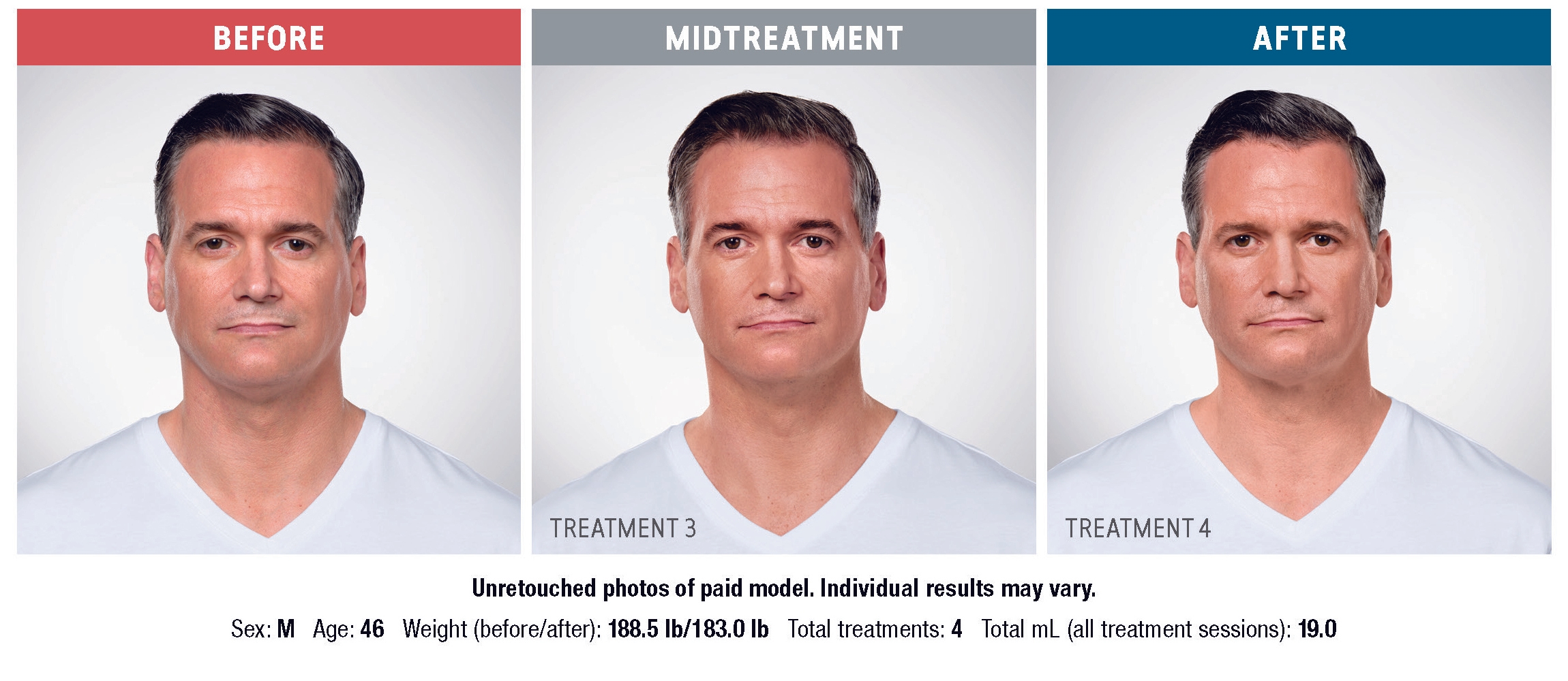 Treatment result 5