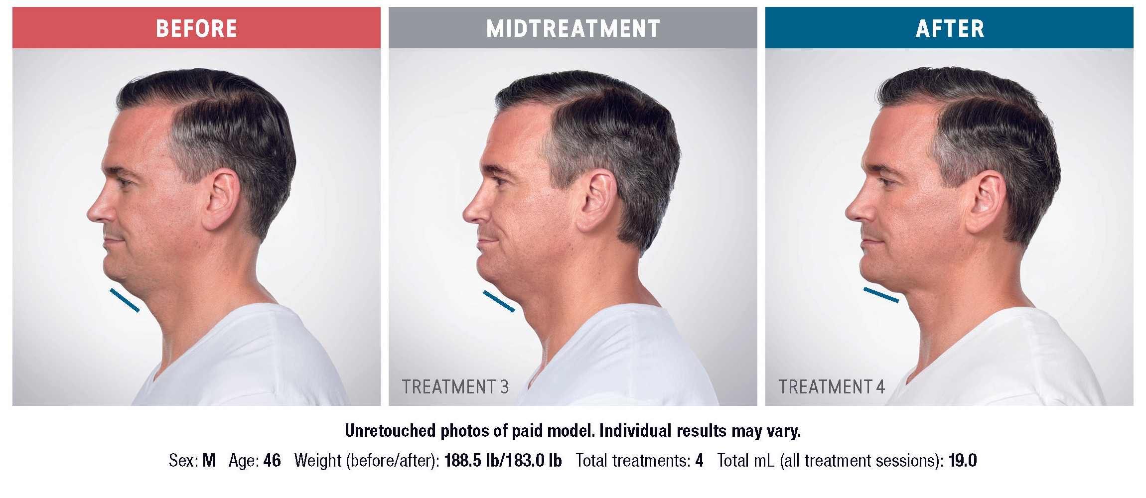 Treatment result 6