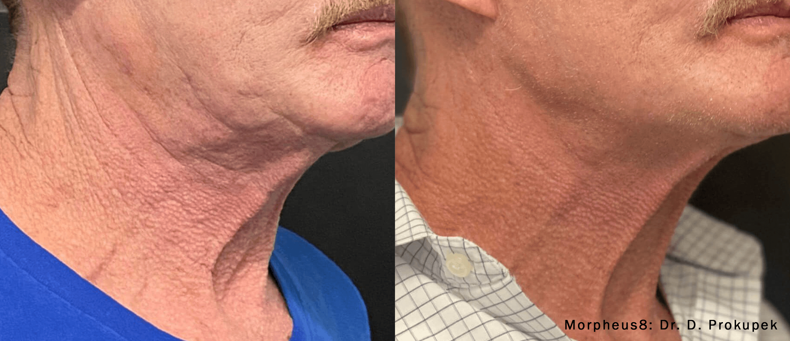 Treatment result 1