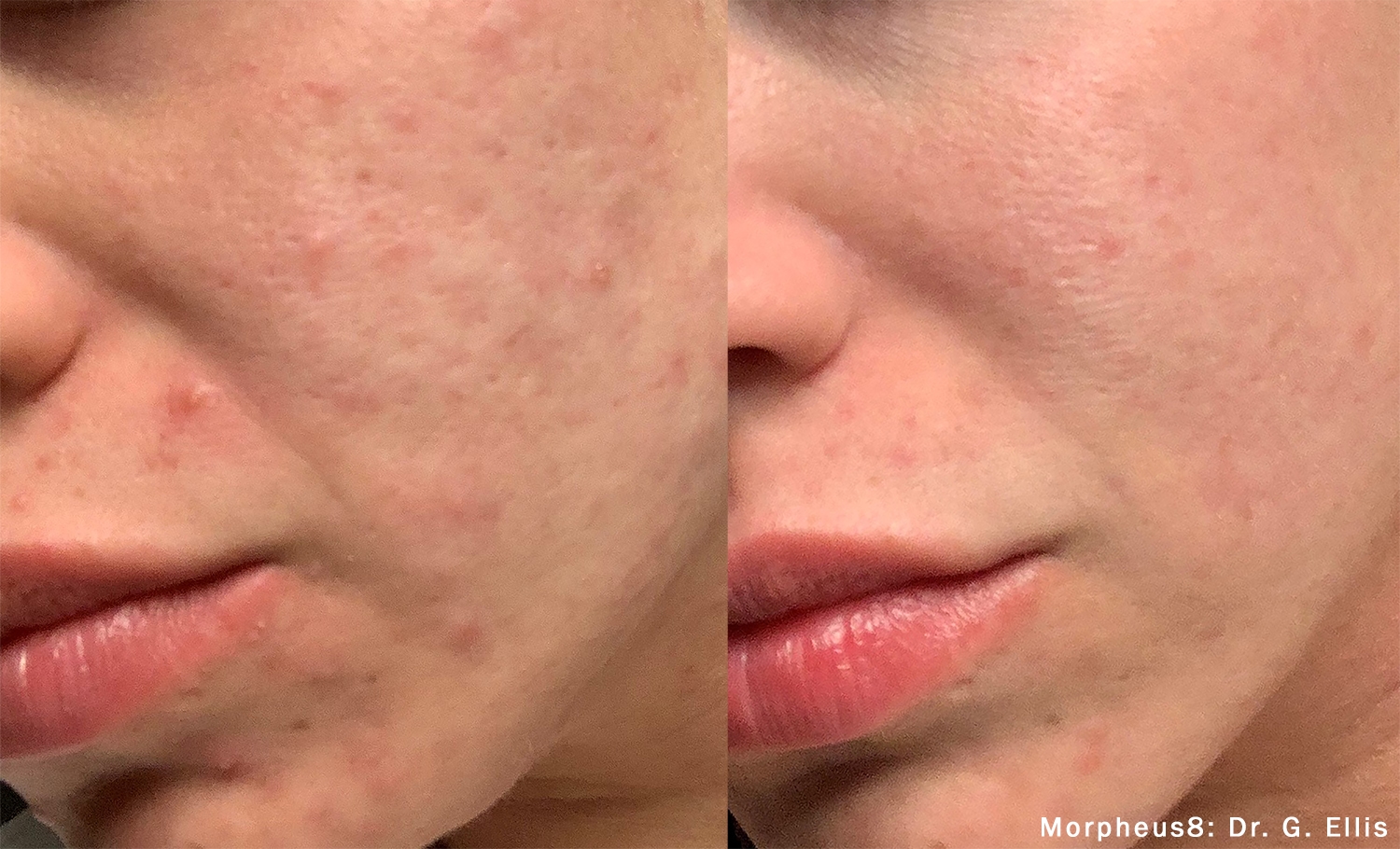 Treatment result 3