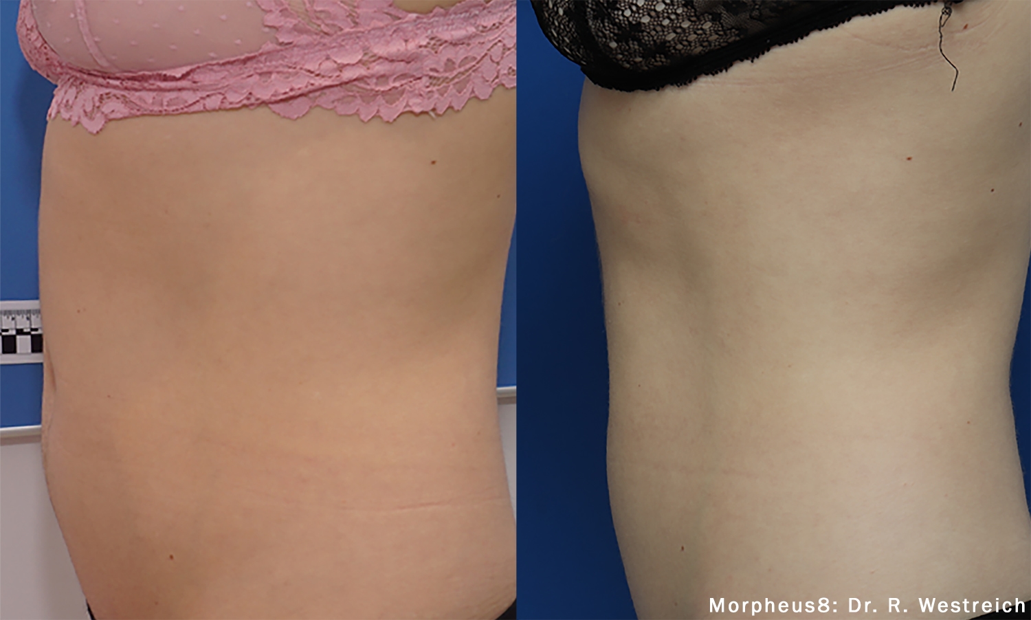 Treatment result 5