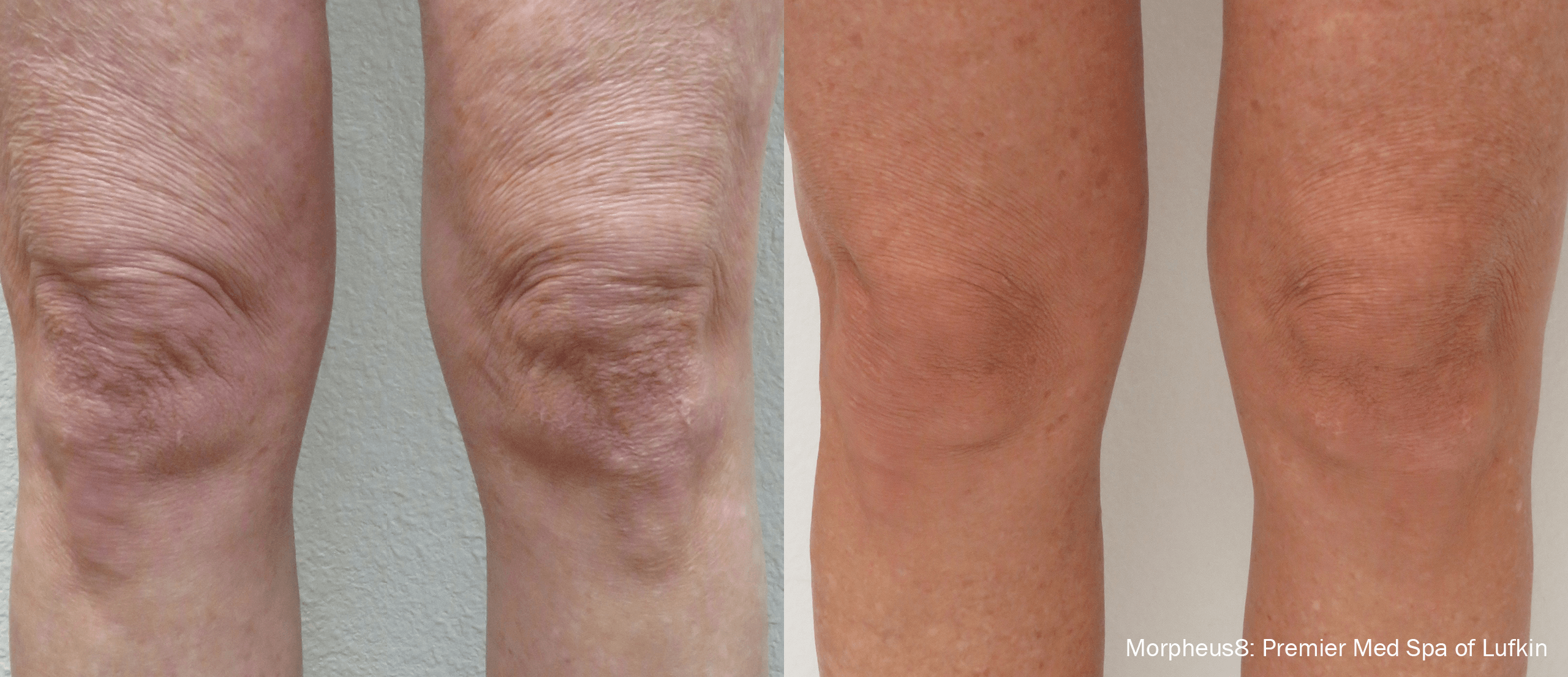 Treatment result 8