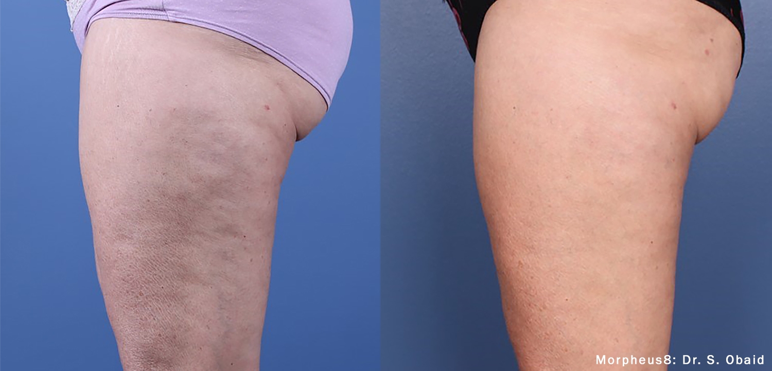 Treatment result 9
