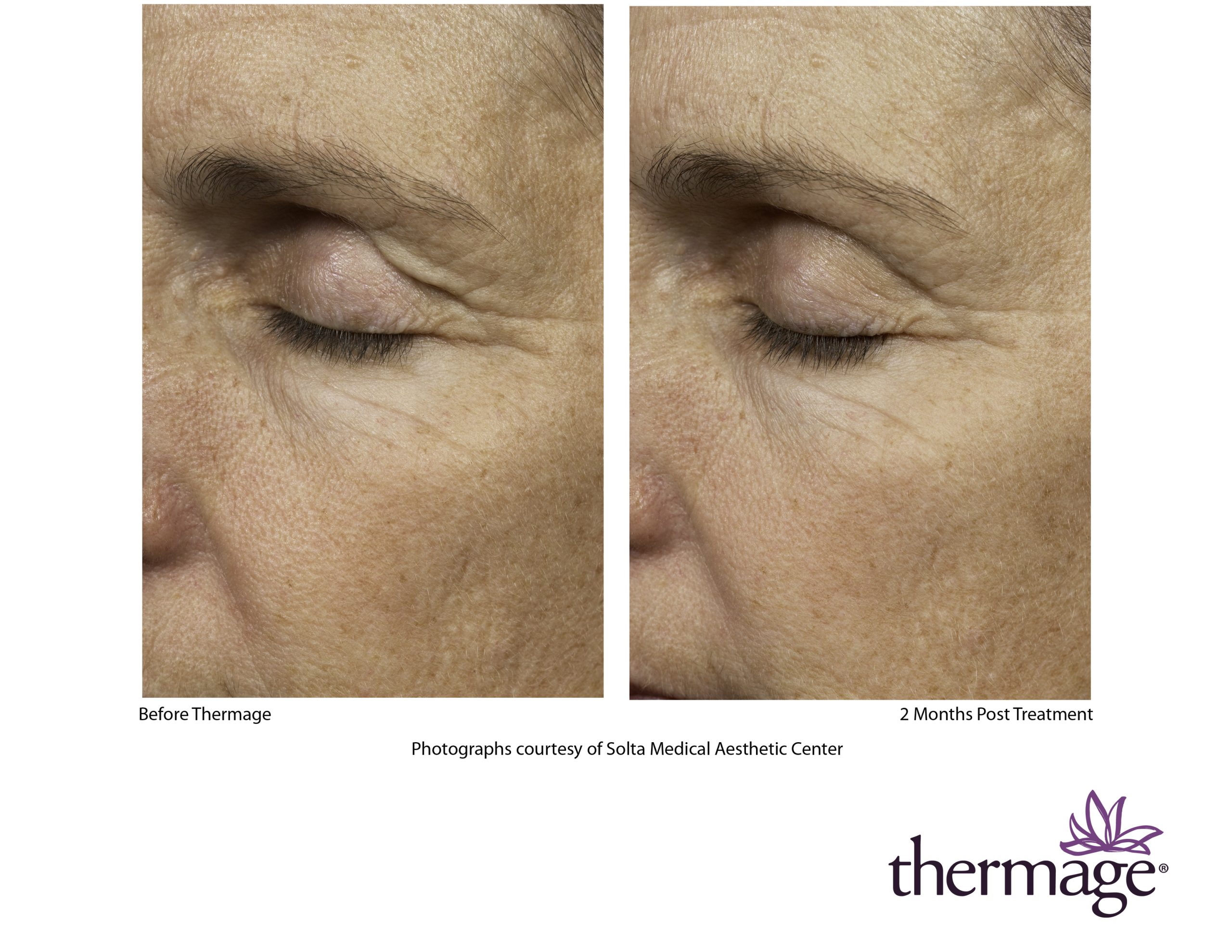 Treatment result 1