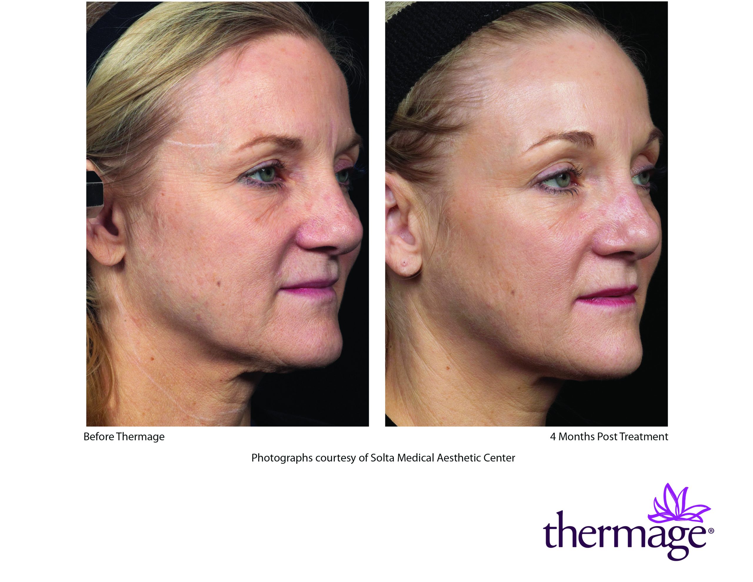 Treatment result 2