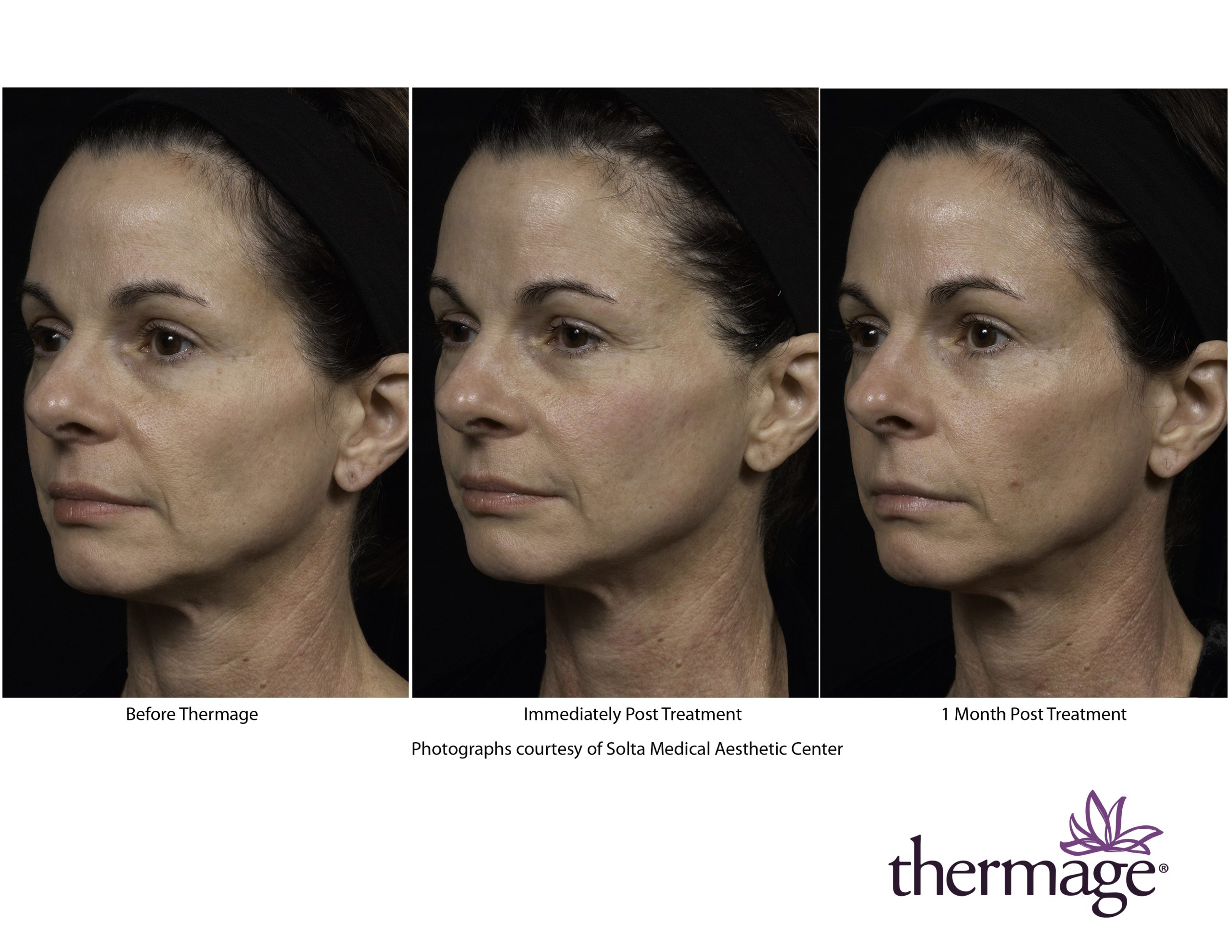 Treatment result 3