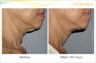 Treatment result 1