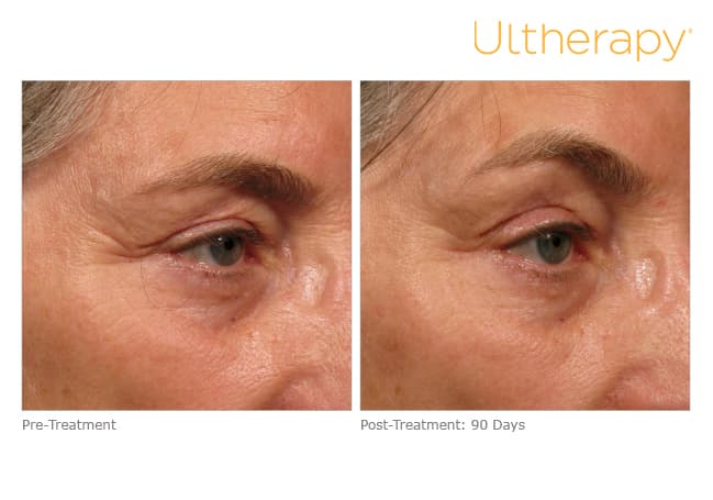 Treatment result 12
