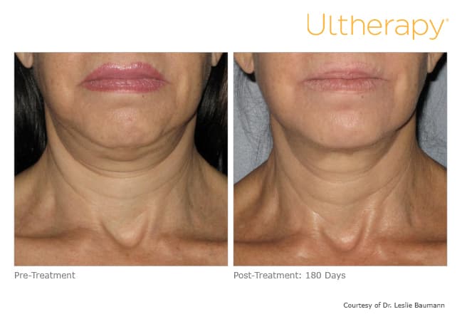 Treatment result 13