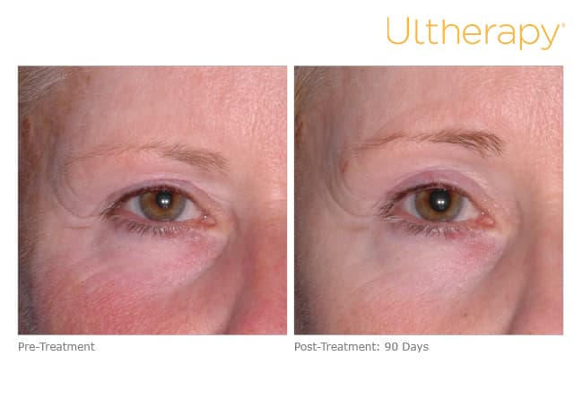Treatment result 20