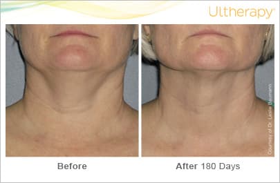 Treatment result 3