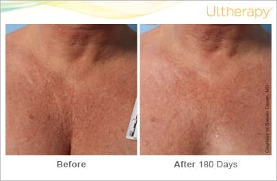 Treatment result 4