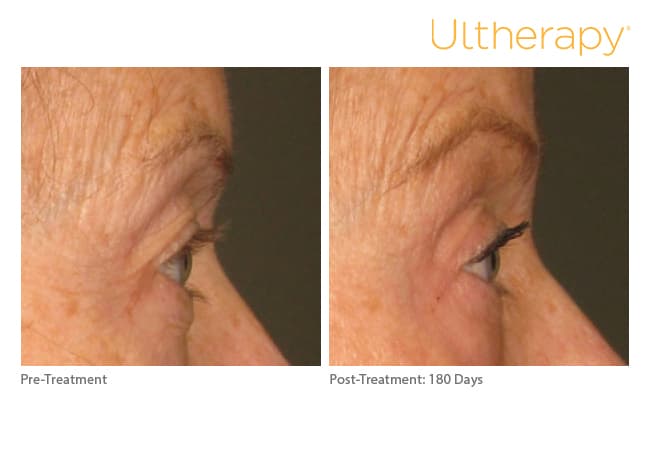 Treatment result 6