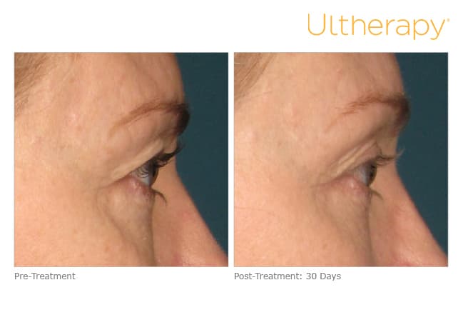 Treatment result 7