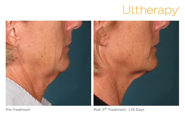 Treatment result 8