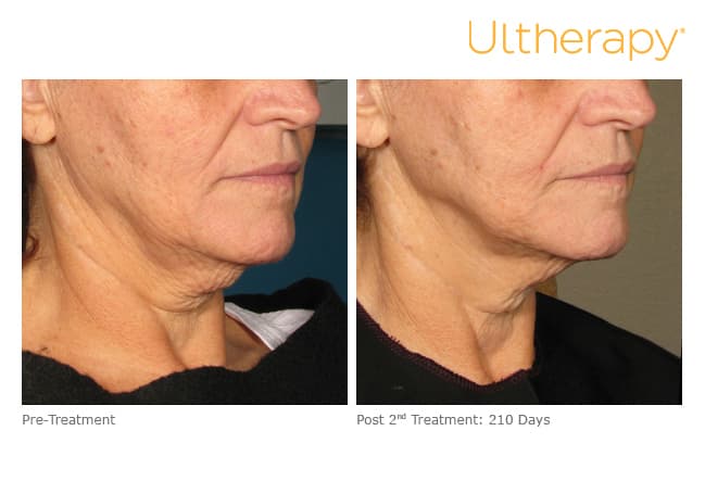 Treatment result 9